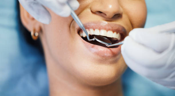 Best Root Canal Emergency Dentist  in Southchase, FL